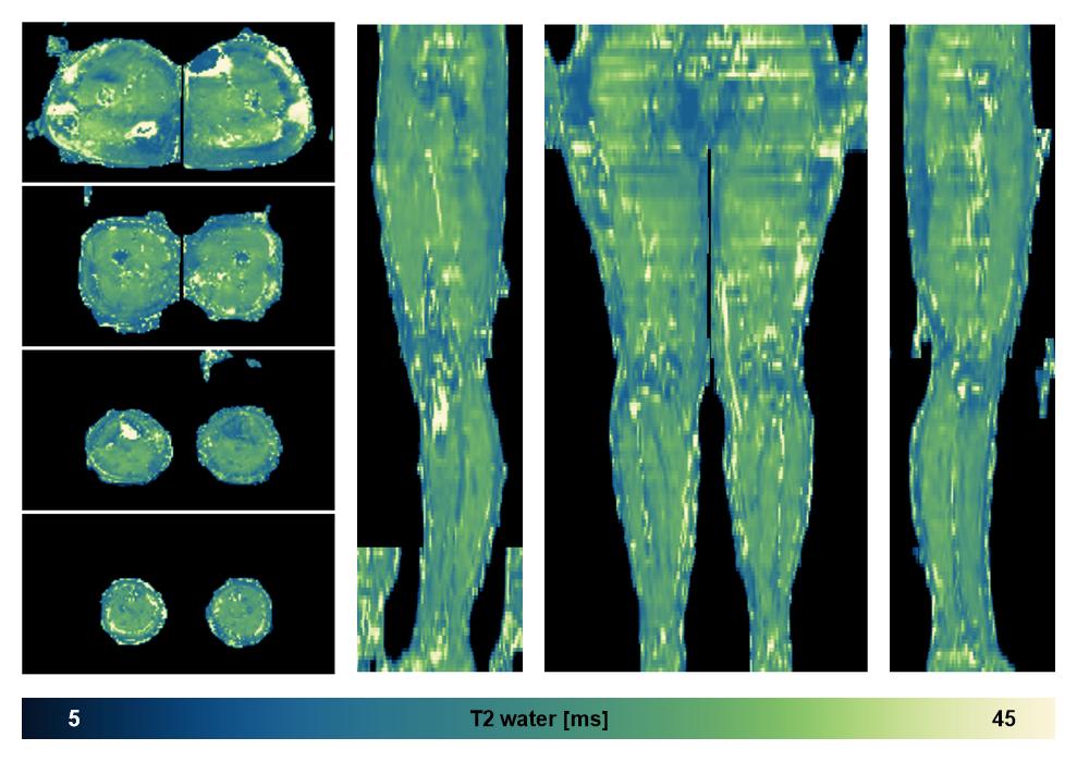 The water only T2 relaxation time of the lower extremity obtained from multi echo spin echo t2 mapping with EPG based reconstruction.